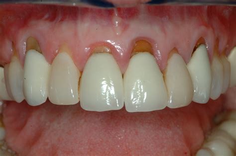 Top 10 Best Gum Graft in Henderson, NV .